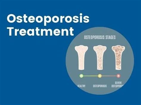 Osteoporosis Medicines Osteoporosis Treatment In Andheri Mumbai