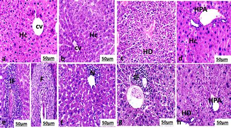 Photomicrograph Of A Liver Section Of A Normal Mouse And B Liver