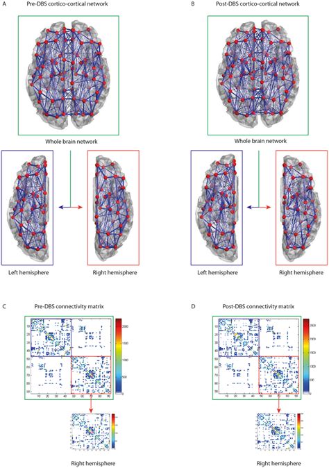 Anatomical Connectivity Networks Derived From Dti Data The Pre And Download Scientific