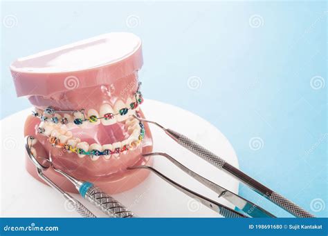 Strumenti Dentistici E Modello Ortodontico Fotografia Stock Immagine