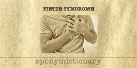 Tietze syndrome • LITFL • Medical Eponym Library