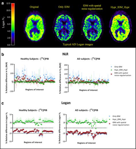 A Typical C Pib V T Images For An Ad Subject Quantitative Effects