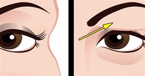 Voici Comment Traiter Naturellement Les Paupi Res Tombantes Paupi Res