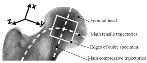 Schematic Representation Of Femoral Head And Neck The Main Tensile And