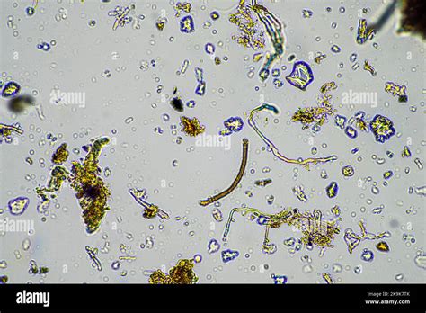 Fungal and fungi hyphae under the microscope in the soil and compost ...