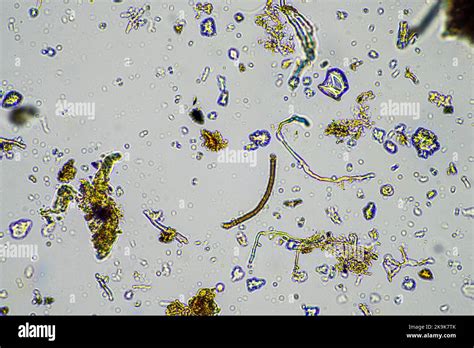 Hyphae Of Fungi Microscope