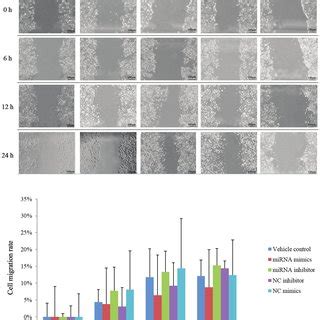 MiR 455 5p Inhibits HT 29 Cell Migration Images Of Colorectal Cancer