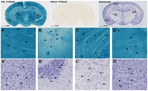 Delivery Of Beta Galactosidase In Mouse Brain Through K16ApoE And