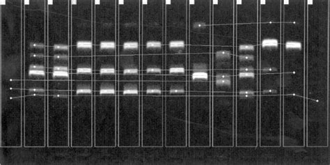 Example Of Random Amplification Of Polymorphic Dna Products Derived