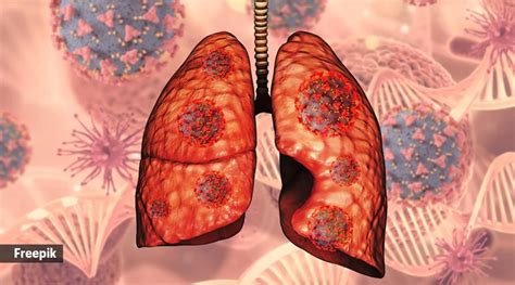 Lung Health Why Diabetics Are More Prone To Asthma Pneumonia Cystic