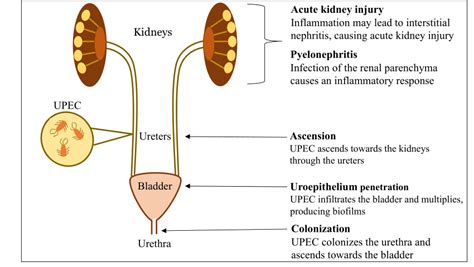 Goulart Db 2021 Urinary Tract Infection Caused By Download Scientific Diagram