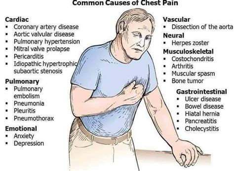 common   chest pain medizzy