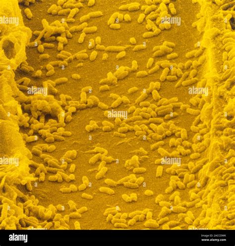 False Colour Scanning Electron Micrograph Of The Rod Shaped Bacteria