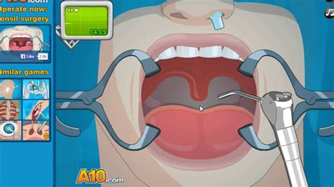 Operate Now TONSIL SURGERY YouTube