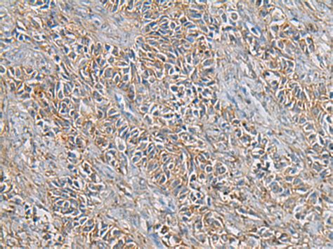 Fth Anti Fth Rabbit Polyclonal Antibody