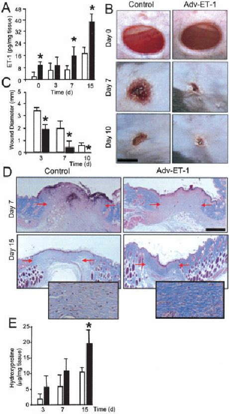 Acceleration Of Wound Closure And Increase In Collagen Deposition In