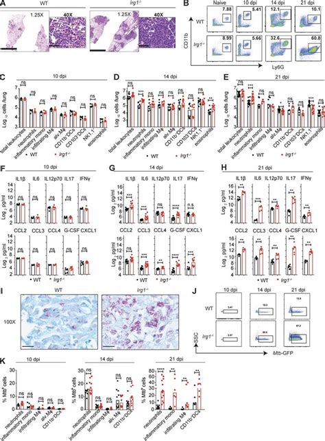 Irg1 Modulates Inflammatory Responses In The Lung After Mtb Infection