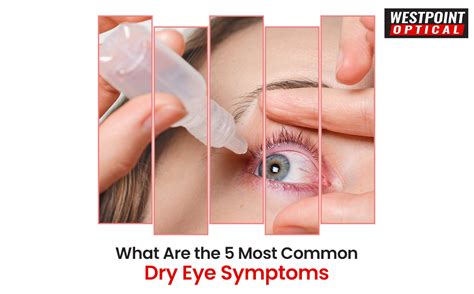 What Are the 5 Most Common Dry Eye Symptoms