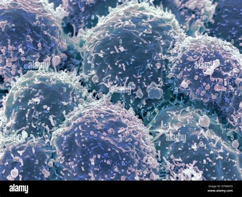 Cancer Cells Hi Res Stock Photography And Images Alamy