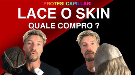 Protesi Capelli Skin O Lace Quale Patch Cutanea E Migliore Te Lo