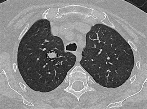 Computertomografie Ct Radiologie Filstal