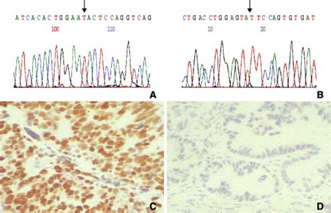 Mutation And Expression Of The Tp53 Gene In Early Stage Epithelial