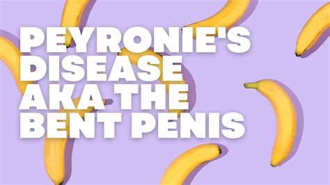 Penyakit Peyronie Penis Bengkok Penis Melengkung Hisential