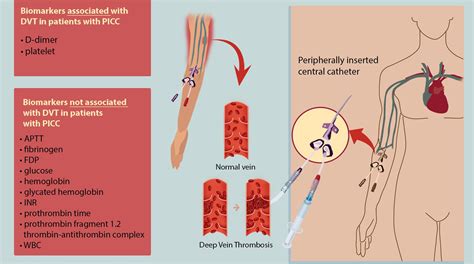 Jcm Free Full Text Biomarkers Associated With Thrombosis In Patients With Peripherally