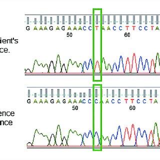 Sanger sequencing results of homozygous c.1642C>T pathogenic variant ... 