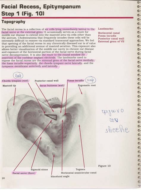 Mastoidectomy Anatomy