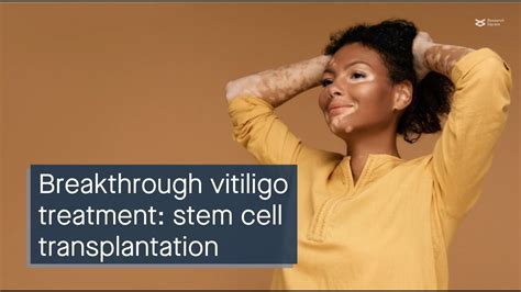 Breakthrough Vitiligo Treatment Hair Follicle Melanocyte Stem Cell Transplantation Youtube