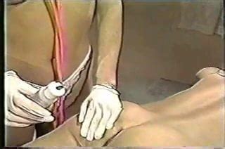 Rectal Temperature Male Patient Maldivian Anal Porn Xhamster