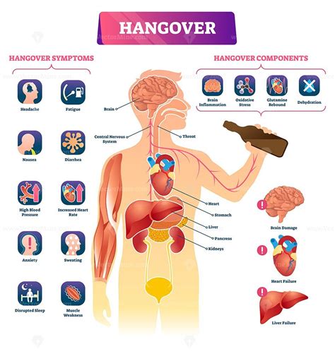 Hangover vector illustration - VectorMine