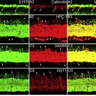 Confocal Microphotographs Showing The Expression Of ChR2 EYFP Transgene