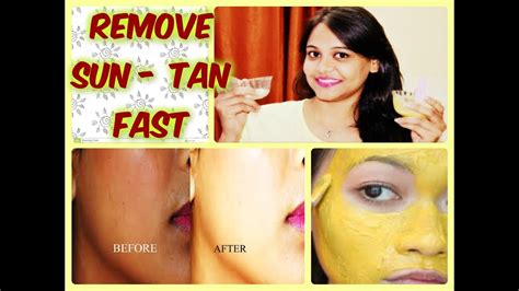 How To Remove Sun Tan Fast From Your Face Body At Home Immediate