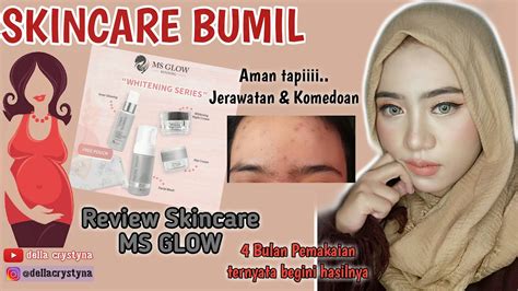 Review Skincare Ms Glow Skincare Bumil Kusam Berminyak Jerawat