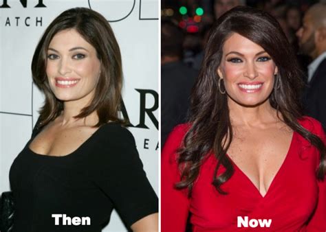 Kimberly Guilfoyle Plastic Surgery Before and After Photos