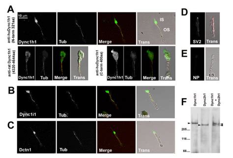 Dync1h1 Dync1i1 And Dnct1 Immunoreactivity Is Associated With