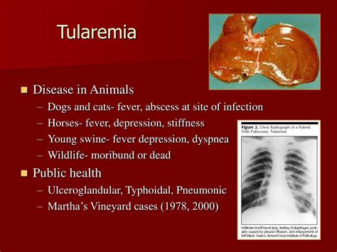 Tularemia Cdc