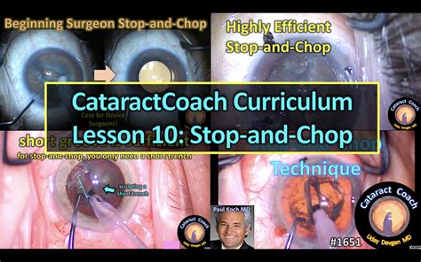 1651 Curriculum Lesson 10 Stop And Chop Cataract Coach™