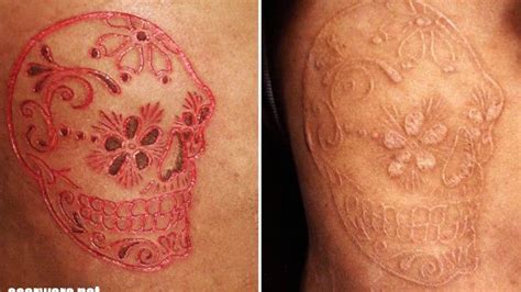 Pin By San Nug On Ichtattoo Motive Scarification Scarification