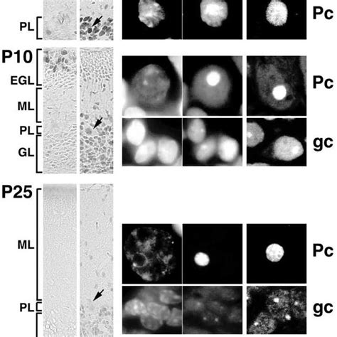 Immunolocalization Of Topo II Isoforms During The Postnatal Cerebellar