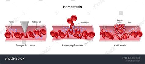 Hemostasis Vector Wound Healing Process Stages Stock Vector (Royalty Free) 2397316685 | Shutterstock