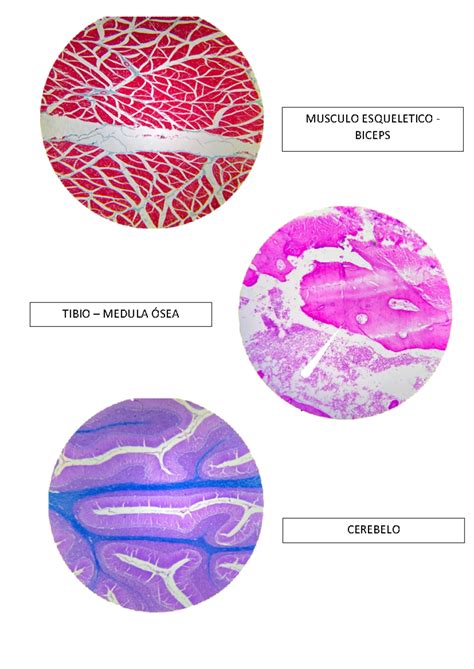 Examen DE Laminas 2 Componente Histología humana MUSCULO