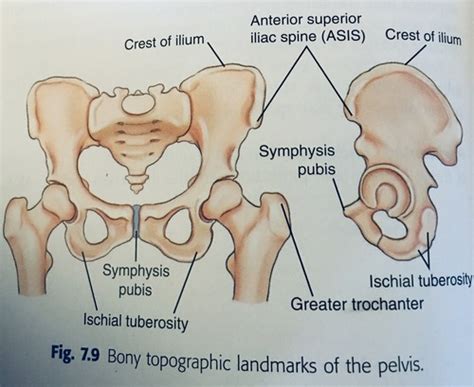 Greater Trochanter Landmark