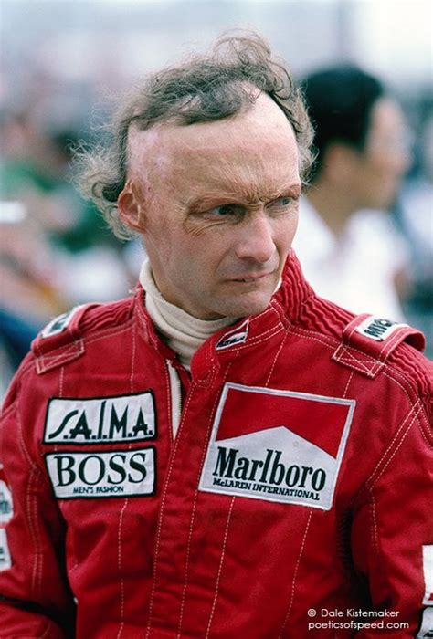 A Rare Image Of Lauda Showing The Full Effect Of His Burns Rformula1