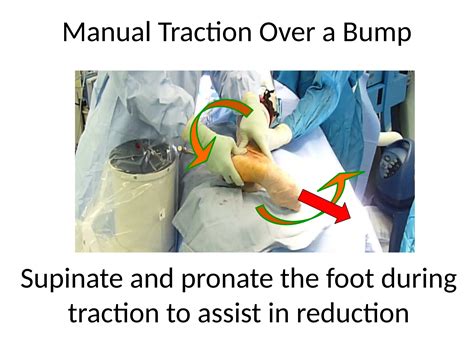 calcaneal fractures management cases PPT.pptx