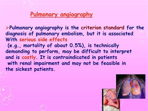 Ppt Diagnosis Of Pulmonary Embolism Powerpoint Presentation Free Download Id 3565428