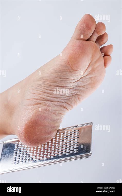 Dry Heels Woman Close Up Isolated On White Background Stock Photo Alamy