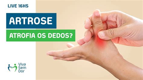 Artrose Nas M Os Pode Causar Atrofia Dos M Sculos Dos Dedos Youtube